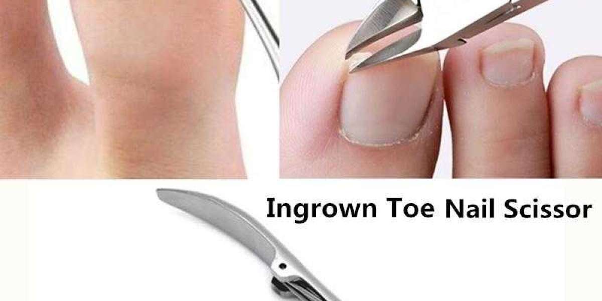 Ingrown Nail Scissors get rid of Ingrown Toenail Pain